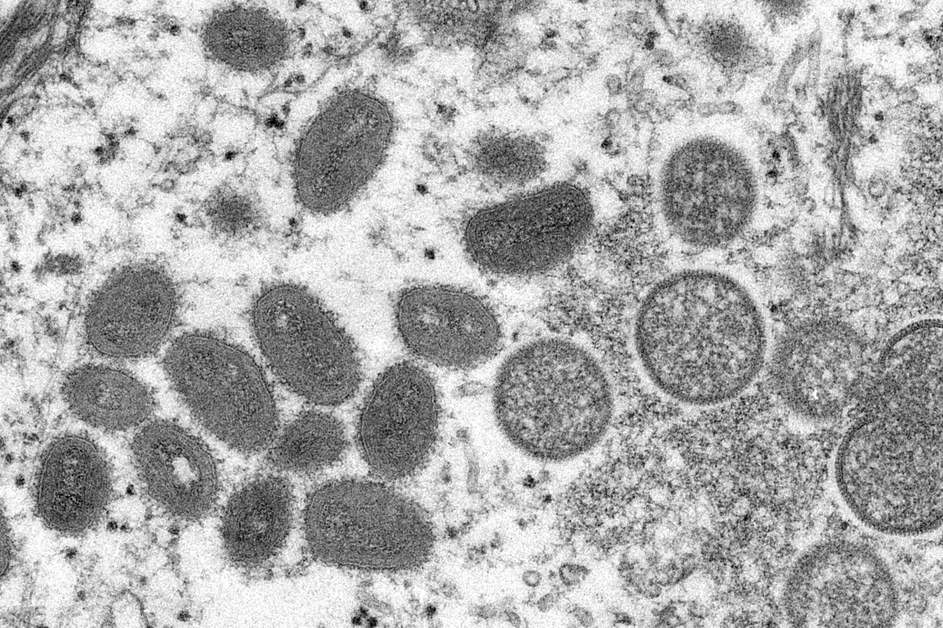 19nyc-monkeypox1-superJumbo