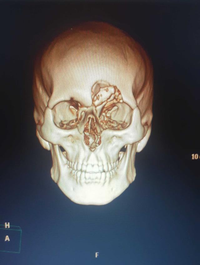 DYGTKLL77ZH6PGPPPWGLBMQV54.jpg