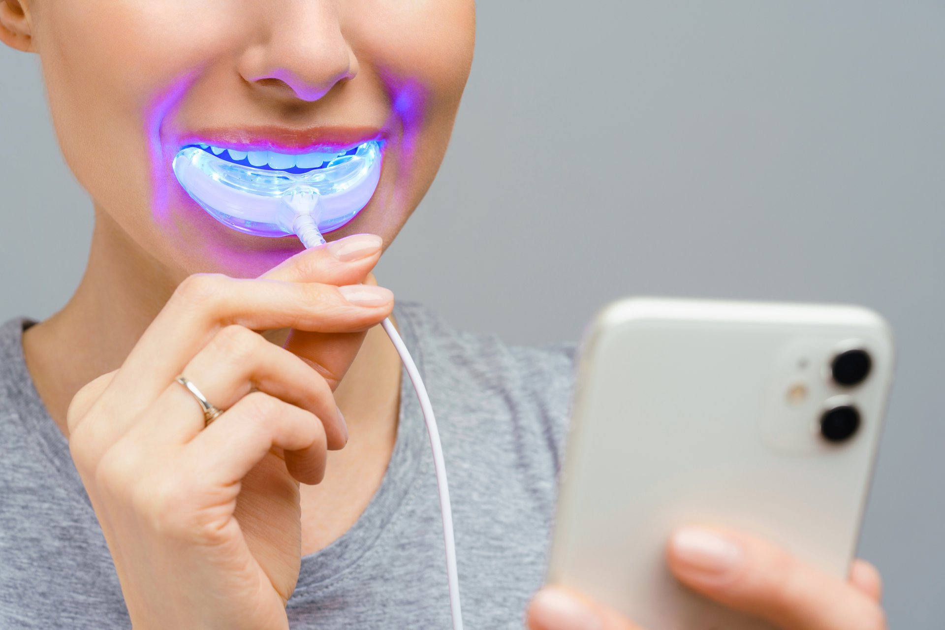 Dientes