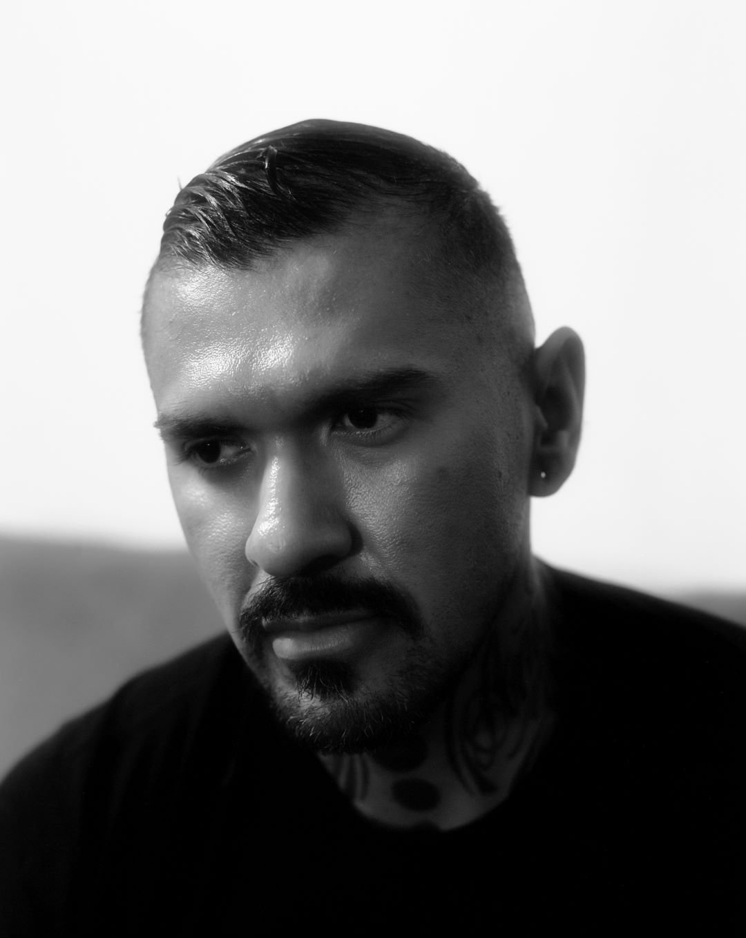 NY MONKEYPOX DIARIES 2-4