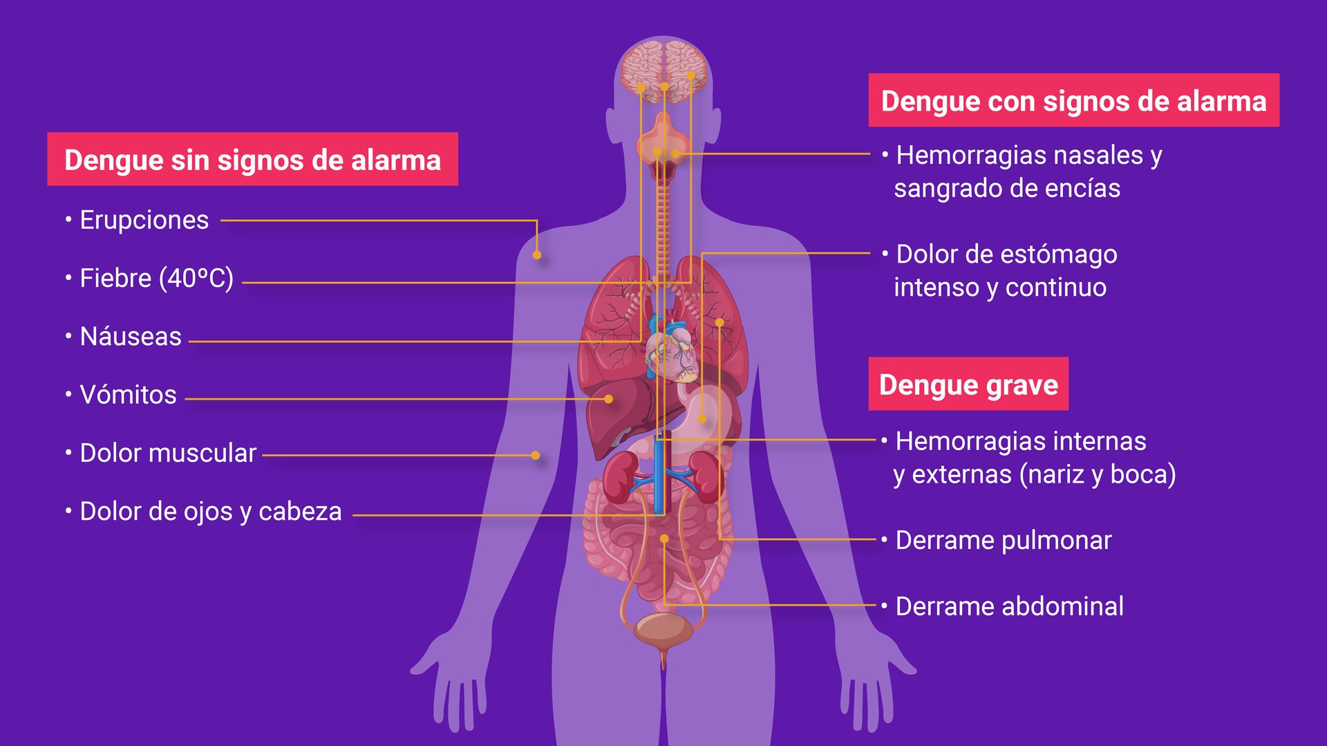 SIGNOS DENGUE_Mesa de trabajo 1-02