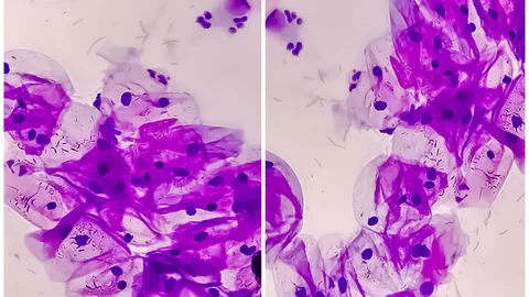 cancerdecuellouterino_Portada