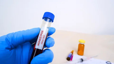 monkeypox-mpxv-blood-sample-in-test-tube-holding-by-doctor-hand