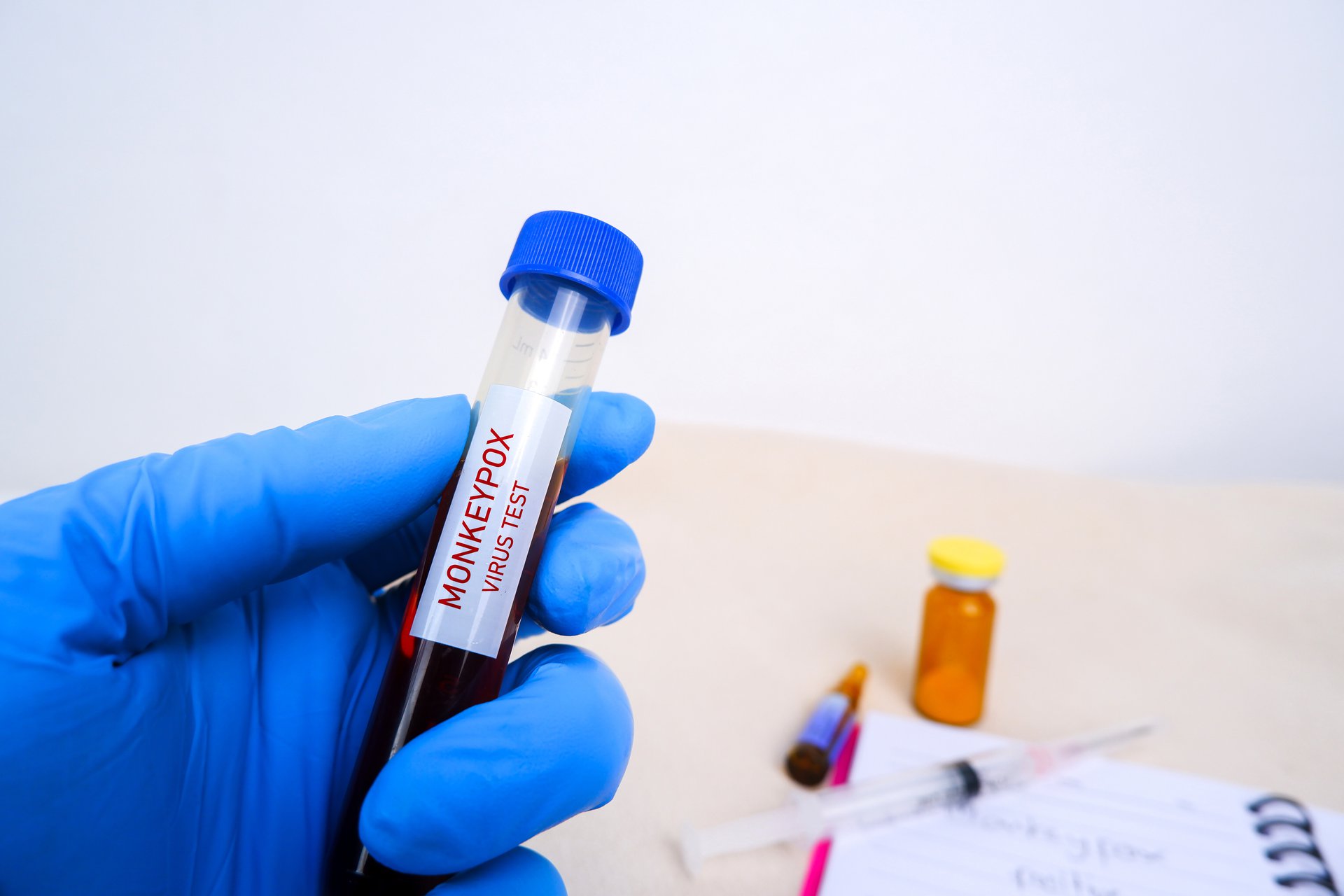 monkeypox-mpxv-blood-sample-in-test-tube-holding-by-doctor-hand