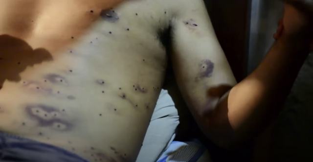 herido perdigones peaje Puente Piedra.PNG
