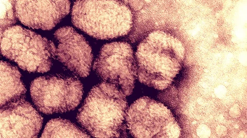 virus-de-la-viruela